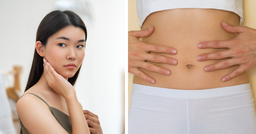 Gut-Skin Axis: How Having A Good Gut Health is Better for Healthier Skin featured image