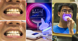 I tried two at-home teeth whitening products and it helped me to achieve teeth that are three shades whiter in just 10 minutes every night featured image