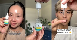 These invisible “liquid pimple patches” are going viral on social media – here’s how they work featured image